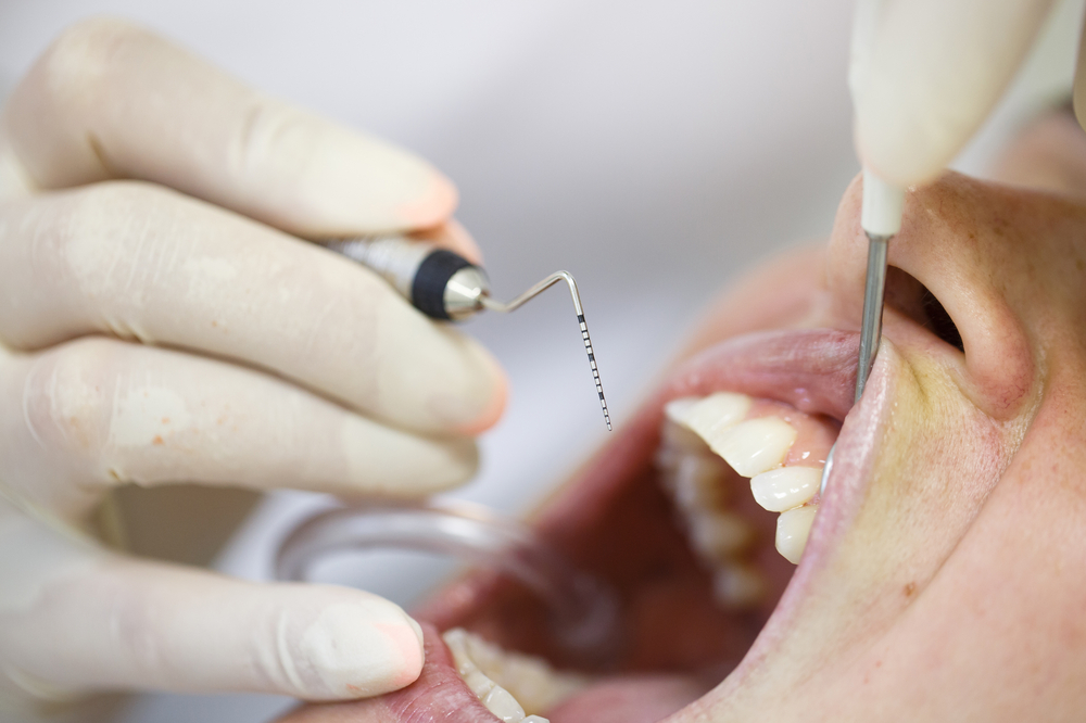 How Can You Effectively Treat Gum Disease?