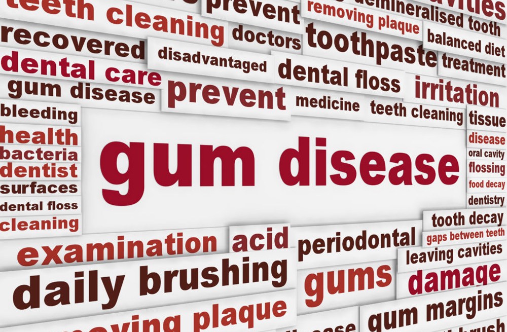 tips to help avoid periodontal disease